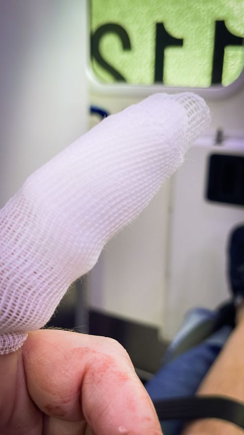 Und weg war er! 🚑🤦🏼‍♂️